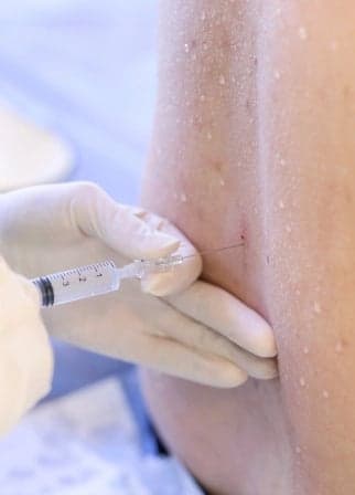 Mastering Lumbar Epidural Injections: A Virtual Guide for Interventional Pain Management