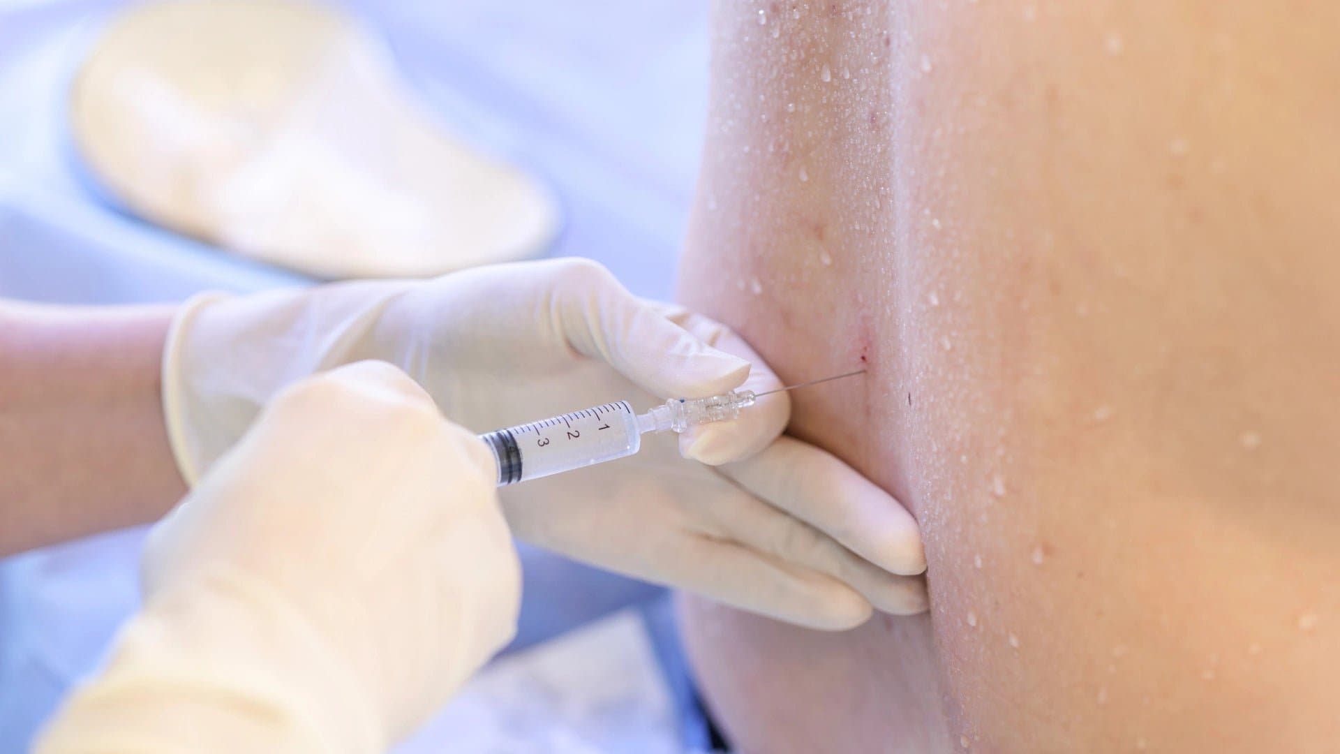 Mastering Lumbar Epidural Injections: A Virtual Guide for Interventional Pain Management